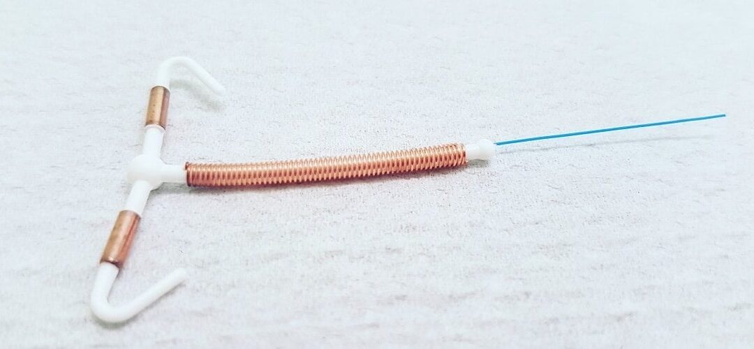 Rimanere incinta nonostante la spirale: come può succedere?